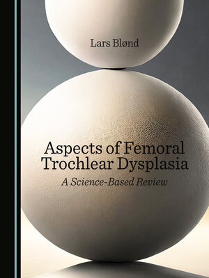cover image of Aspects of Femoral Trochlear Dysplasia